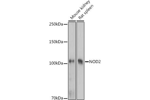 NOD2 抗体  (AA 611-910)
