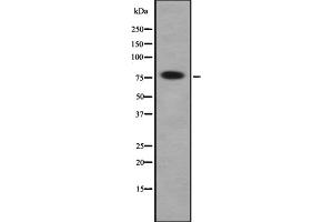 Western blot analysis of Dynein IC1 using COLO205 whole cell lysates