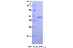 Image no. 1 for Protein Disulfide Isomerase Family A, Member 3 (PDIA3) (AA 162-416) protein (His tag) (ABIN1877466)