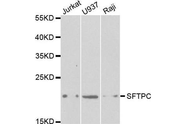 Surfactant Protein C Antikörper  (AA 1-197)