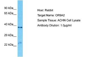 Image no. 1 for anti-Olfactory Receptor, Family 9, Subfamily A, Member 2 (OR9A2) (C-Term) antibody (ABIN2791796)