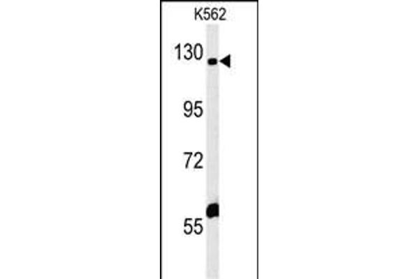 IQSEC3 抗体  (N-Term)