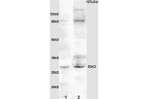 Image no. 3 for anti-Insulin-Like Growth Factor Binding Protein 3 (IGFBP3) (AA 186-292) antibody (ABIN686497)