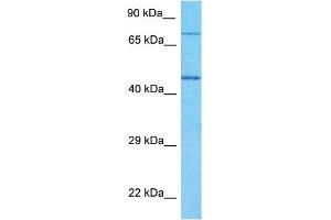 Image no. 1 for anti-Glyceronephosphate O-Acyltransferase (GNPAT) (N-Term) antibody (ABIN5516033)