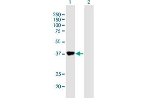 Image no. 1 for anti-Paraneoplastic Antigen MA1 (PNMA1) (AA 1-353) antibody (ABIN522701)