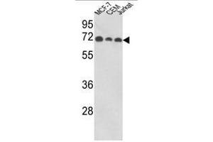 Image no. 3 for anti-Abl-Interactor 1 (ABI1) (AA 87-117), (N-Term) antibody (ABIN453492)