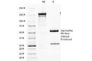 Image no. 3 for anti-Parathyroid Hormone (PTH) (AA 32-115) antibody (ABIN3024771)