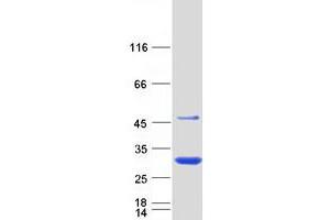 Image no. 1 for N-6 Adenine-Specific DNA Methyltransferase 2 (Putative) (N6AMT2) protein (Myc-DYKDDDDK Tag) (ABIN2726748)