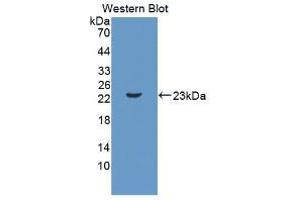 Image no. 1 for anti-Interleukin 11 (IL11) (AA 25-199) antibody (ABIN2935340)