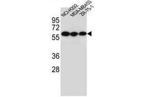 CHRNA10 Antibody (Center) western blot analysis in NCI-H292,MDA-MB453,ZR-75-1 cell line lysates (35µg/lane).