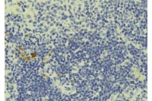 Image no. 2 for anti-Pericentriolar Material 1 (PCM1) antibody (ABIN6264068)