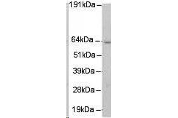 anti-MUS81 Endonuclease Homolog (MUS81) antibody
