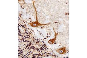Image no. 3 for anti-Palmitoyl-Protein Thioesterase 1 (PPT1) antibody (ABIN4913200)