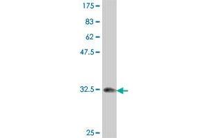 Image no. 1 for anti-Topoisomerase (DNA) I (TOP1) (AA 692-765) antibody (ABIN563221)