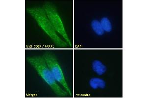 Image no. 2 for anti-FERM, RhoGEF (ARHGEF) and Pleckstrin Domain Protein 1 (Chondrocyte-Derived) (FARP1) (N-Term) antibody (ABIN185104)