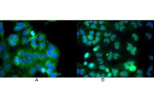 Image no. 3 for anti-Nuclear Factor-kB p65 (NFkBP65) (C-Term) antibody (ABIN964680)