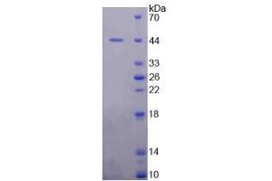 Image no. 1 for Mdm2, p53 E3 Ubiquitin Protein Ligase Homolog (Mouse) (MDM2) (AA 1-321) protein (His tag) (ABIN6237510)