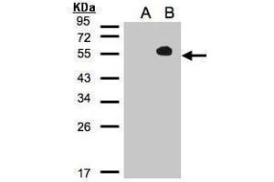 Image no. 1 for anti-TGF-beta Activated Kinase 1/MAP3K7 Binding Protein 1 (TAB1) (Center) antibody (ABIN2855576)