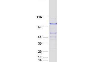Image no. 1 for DDB1 and CUL4 Associated Factor 8 (DCAF8) protein (Myc-DYKDDDDK Tag) (ABIN2735514)