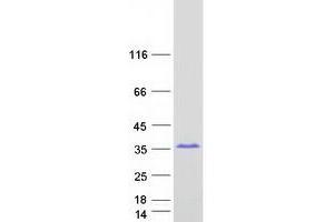Image no. 1 for Sperm Associated Antigen 16 (SPAG16) (Transcript Variant 2) protein (Myc-DYKDDDDK Tag) (ABIN2732488)