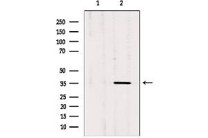 Image no. 3 for anti-Olfactory Receptor, Family 3, Subfamily A, Member 1 (OR3A1) antibody (ABIN6259522)
