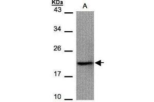 WB Image Sample(30 μg of whole cell lysate) A:293T 15% SDS PAGE antibody diluted at 1:1000