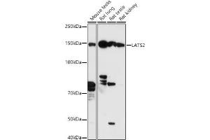 LATS2 antibody  (AA 1-100)