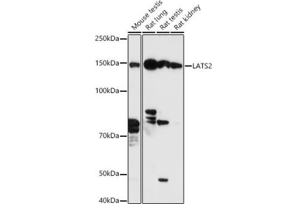 LATS2 antibody  (AA 1-100)
