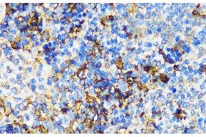 Immunohistochemistry of paraffin-embedded Mouse spleen using PBEF / NAMPT Polyclonal Antibody at dilution of 1:100 (40x lens).