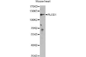 Image no. 1 for anti-Procollagen-Lysine,2-Oxoglutarate 5-Dioxygenase 1 (PLOD1) antibody (ABIN6568253)
