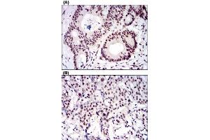 Image no. 4 for anti-Catenin, beta Like 1 (CTNNBL1) antibody (ABIN5576182)