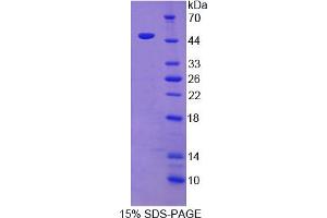 Image no. 1 for Neurotrophic tyrosine Kinase, Receptor, Type 3 (NTRK3) (AA 32-429) protein (His tag) (ABIN6238339)