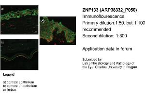 Image no. 2 for anti-Zinc Finger Protein 133 (ZNF133) (Middle Region) antibody (ABIN2780519)
