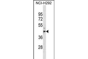 MPPE1 抗体  (C-Term)