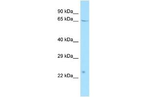 Image no. 1 for anti-Activating Transcription Factor 7 Interacting Protein 2 (ATF7IP2) (N-Term) antibody (ABIN2790606)