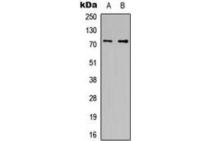 Image no. 3 for anti-Cell Division Cycle 16 Homolog (S. Cerevisiae) (CDC16) (C-Term) antibody (ABIN2704624)