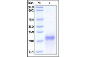 Biotinylated Human VEGF165 on SDS-PAGE under reducing (R) and no-reducing (NR) conditions.