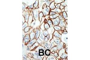 Image no. 1 for anti-Histone Deacetylase 11 (HDAC11) (AA 313-345), (C-Term) antibody (ABIN387965)