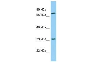 Image no. 1 for anti-Kallikrein 2 (KLK2) (Middle Region) antibody (ABIN2777023)