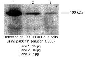 anti-F-Box Protein 11 (FBXO11) (Internal Region) antibody