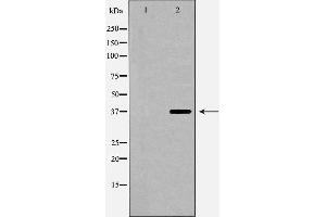 Image no. 2 for anti-Complement Factor H-Related 1 (CFHR1) antibody (ABIN6260778)