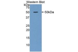 Image no. 1 for anti-Orosomucoid 1 (ORM1) (AA 33-195) antibody (ABIN1857835)