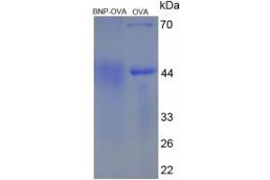 Image no. 3 for Brain Natriuretic Peptide (BNP) protein (Ovalbumin) (ABIN1880241)