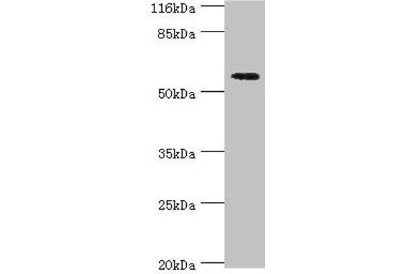 ACBD5 Antikörper  (AA 1-461)