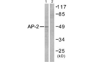 Image no. 3 for anti-Transcription Factor AP-2 alpha (Activating Enhancer Binding Protein 2 Alpha) (TFAP2A) (C-Term) antibody (ABIN1848430)