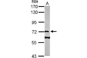 Image no. 3 for anti-DENN/MADD Domain Containing 1B (DENND1B) (Center) antibody (ABIN2856495)