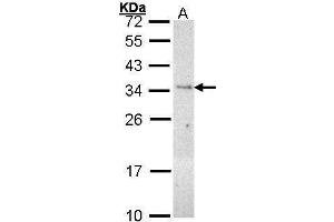 Image no. 1 for anti-phospholipid Scramblase 3 (PLSCR3) (Center) antibody (ABIN2855250)