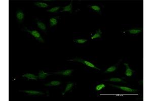 Image no. 2 for anti-Nuclear Factor of Activated T-Cells 5, Tonicity-Responsive (NFAT5) (AA 1-1484) antibody (ABIN524154)