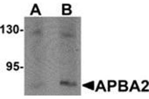 Image no. 1 for anti-Amyloid beta (A4) Precursor Protein-Binding, Family A, Member 2 (APBA2) (Center) antibody (ABIN783771)