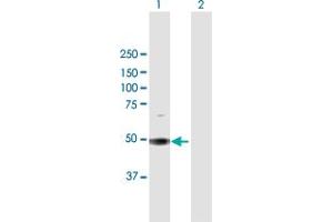 Image no. 1 for anti-Suppressor of Cytokine Signaling 5 (SOCS5) (AA 1-536) antibody (ABIN948837)